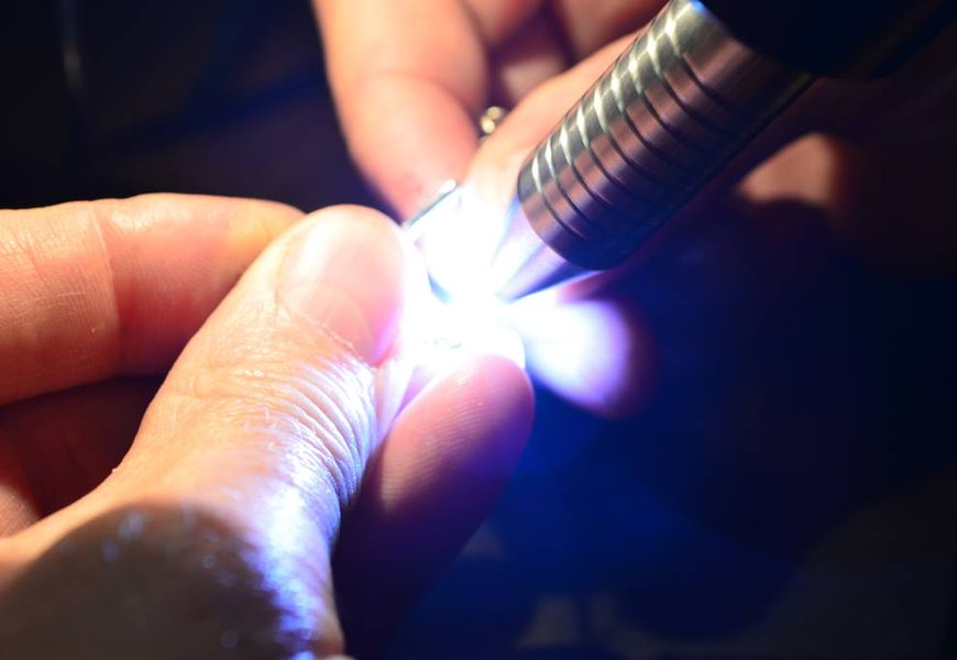 Advantages of laser soldering at the jeweler