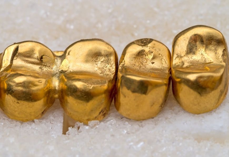 Протезирование в стоматологии золото 
