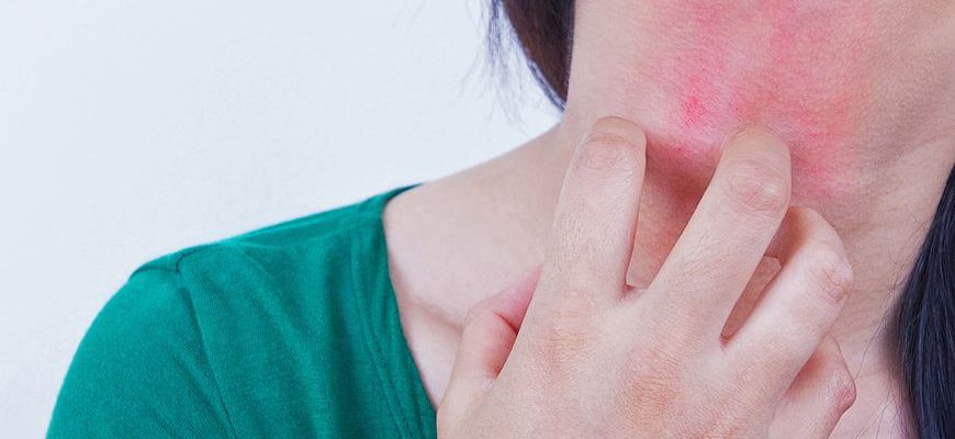 Признаки астмы у взрослого симптомы на фоне аллергии